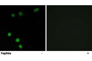 Immunofluorescence analysis of MCF-7 cells, using TP53INP2 polyclonal antibody . (TP53INP2 抗体)
