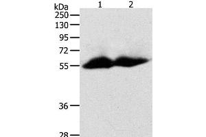 Western Blot analysis of Human colon and ovarian cancer tissue using MMP11 Polyclonal Antibody at dilution of 1:600 (MMP11 抗体)