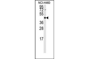 Image no. 1 for anti-Required For Meiotic Nuclear Division 5 Homolog B (RMND5B) (C-Term) antibody (ABIN357964) (RMND5B 抗体  (C-Term))