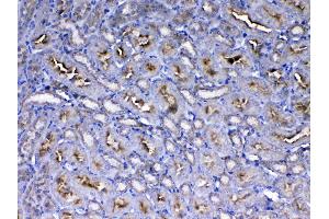 IHC analysis of IGF1 Receptor using anti-IGF1 Receptor antibody . (IGF1R 抗体  (AA 31-257))
