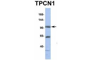 Host:  Rabbit  Target Name:  TPCN1  Sample Type:  HT1080  Antibody Dilution:  1. (TPCN1 抗体  (N-Term))