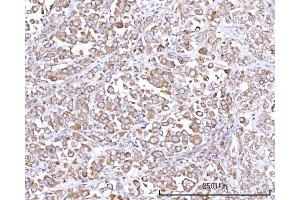 IHC analysis of RPN1 using anti-RPN1 antibody (ABIN7600447). (RPN1 抗体  (AA 196-495))