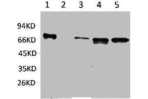 Western blot analysis of 1) Hela, 2) Jurkat, 3) Mouse Brain, 4) Mouse Kidney, 5) Rat Brain using ZBTB45 Polyclonal Antibody. (ZBTB45 抗体)