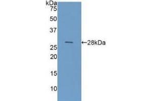 Western Blotting (WB) image for Galectin 3 (LGALS3) ELISA Kit (ABIN6720558)