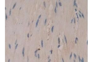 Immunohistochemistry (IHC) image for anti-Coronin, Actin Binding Protein, 1A (CORO1A) (AA 7-204) antibody (ABIN7436672)