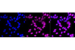 Immunocytochemical staining of HepG2 cells with ETS1 antibody (ABIN7800794), 1:1,000).