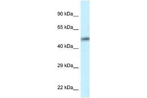 Western Blot showing CAMK2D antibody used at a concentration of 1 ug/ml against HT1080 Cell Lysate (CAMK2D 抗体  (C-Term))