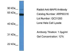 WB Suggested Anti-MAP6  Antibody Titration: 0. (MAP6 抗体  (N-Term))