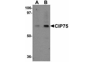 Image no. 1 for anti-Ubiquilin 4 (UBQLN4) (N-Term) antibody (ABIN478130) (UBQLN4 抗体  (N-Term))
