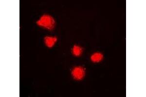 Immunofluorescent analysis of BMI1 staining in K562 cells. (BMI1 抗体)