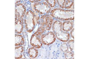 Immunohistochemistry (IHC) image for anti-ClpP Caseinolytic Peptidase, ATP-Dependent, Proteolytic Subunit Homolog (E. Coli) (CLPP) antibody (ABIN1682296)