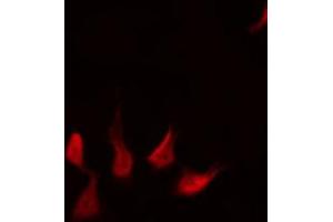 ABIN6267577 staining HepG2 by IF/ICC. (XIAP 抗体  (pSer87))