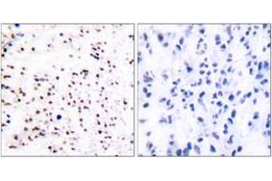 Immunohistochemistry (IHC) image for anti-Minichromosome Maintenance Complex Component 5 (MCM5) (AA 21-70) antibody (ABIN2889223)