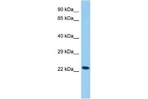 Host: Rabbit Target Name: Cdo1 Sample Type: Rat Testis lysates Antibody Dilution: 1. (CDO1 抗体  (C-Term))
