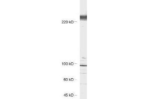 antibody dilution: 1 : 1000, sample: rat hippocampus lysate (CACNA1B 抗体)