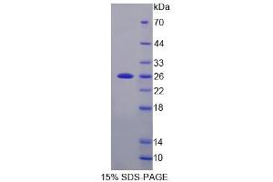 SDS-PAGE analysis of Mouse CDKN1B Protein. (CDKN1B 蛋白)