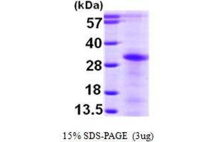 SDS-PAGE (SDS) image for Linker For Activation of T Cells Family, Member 2 (LAT2) (AA 27-243) protein (His tag) (ABIN666998)