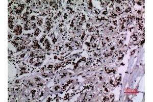 Immunohistochemistry (IHC) analysis of paraffin-embedded Human Breast, antibody was diluted at 1:100. (HSP90 抗体  (acLys284, acLys292))