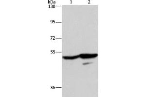 Western Blot analysis of A431 and K562 cell using GPR39 Polyclonal Antibody at dilution of 1:200 (GPR39 抗体)