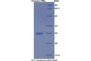 SDS-PAGE analysis of Human PML Protein. (PML 蛋白)