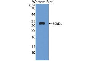 Western blot analysis of the recombinant protein. (ATP1B4 抗体  (AA 132-356))