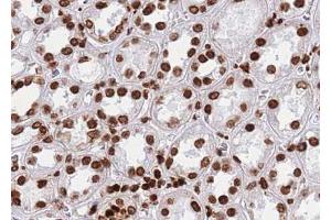 Immunohistochemistry (IHC) image for anti-Zinc Finger Protein 148 (ZNF148) (N-Term) antibody (ABIN6266110)