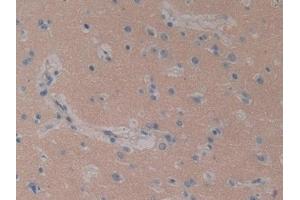 Immunohistochemistry (IHC) image for anti-Signal Transducing Adaptor Molecule (SH3 Domain and ITAM Motif) 1 (STAM) (AA 196-465) antibody (ABIN7442918)