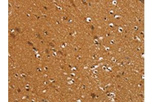 The image on the left is immunohistochemistry of paraffin-embedded Human brain tissue using ABIN7192401(SLC16A3 Antibody) at dilution 1/30, on the right is treated with synthetic peptide. (SLC16A3 抗体)