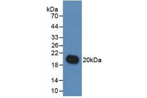 Detection of Recombinant IL19, Human using Monoclonal Antibody to Interleukin 19 (IL19)