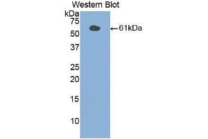 Western blot analysis of the recombinant protein. (PLAA 抗体  (AA 534-792))