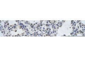 Rabbit Anti-DDX17 Antibody       Paraffin Embedded Tissue:  Human alveolar cell   Cellular Data:  Epithelial cells of renal tubule  Antibody Concentration:   4. (DDX17 抗体  (N-Term))