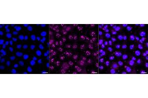 Immunocytochemical staining of HT- cells with Proteasome activator subunit 1 antibody (ABIN7799957), 1:1,000). (Recombinant LACBIDRAFT 301065 抗体  (Subunit 1))