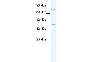 WB Suggested Anti-MCM4 Antibody Titration:  1. (MCM4 抗体  (Middle Region))