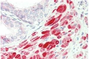 Human, Prostate: Formalin-Fixed Paraffin-Embedded (FFPE) (FLII 抗体  (AA 1116-1165))