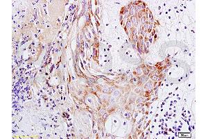 Formalin-fixed and paraffin embedded rat skin tissue labeled with Anti-S100A7 Polyclonal Antibody, Unconjugated (ABIN718301) at 1:200 followed by conjugation to the secondary antibody and DAB staining (S100A7A 抗体  (AA 41-108))