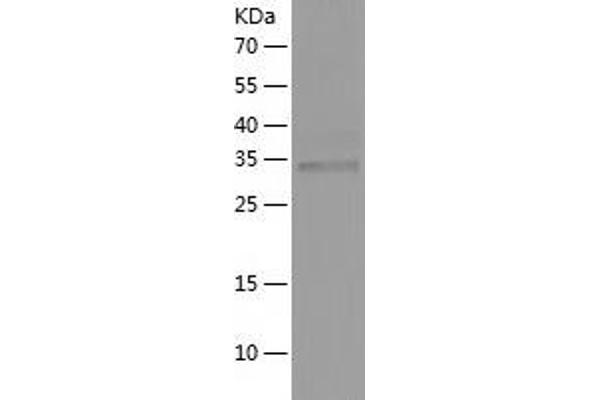 Follistatin Protein (FST) (AA 30-344) (His tag)