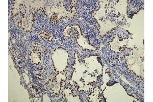 anti-Transcription Termination Factor, RNA Polymerase I (TTF1) (AA 97-110), (N-Term) antibody