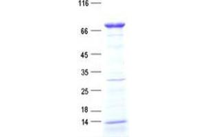 Western Blotting (WB) image for Family with Sequence Similarity 149, Member B1 (FAM149B1) protein (His tag) (ABIN5505631)