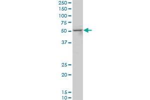 SMAD3 monoclonal antibody (M05), clone 4D5. (SMAD3 抗体  (AA 1-110))