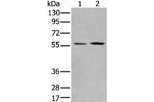 Western Blotting (WB) image for anti-PiggyBac Transposable Element Derived 2 (PGBD2) antibody (ABIN2422351) (PGBD2 抗体)