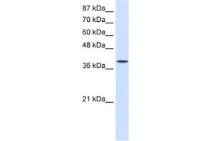 Western Blotting (WB) image for anti-Eukaryotic Translation Initiation Factor 4 gamma 2 (EIF4G2) antibody (ABIN2462107) (EIF4G2 抗体)