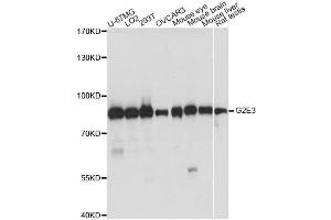 Western blot analysis of extracts of various cell lines, using G2E3 antibody. (G2E3 抗体)