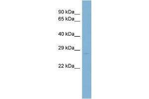 WB Suggested Anti-SSX1 Antibody Titration: 0. (SSX1 抗体  (Middle Region))