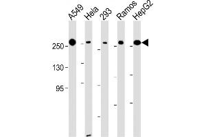All lanes : Anti-FASN Antibody (Center) at 1:500-1:2000 dilution Lane 1: A549 whole cell lysate Lane 2: Hela whole cell lysate Lane 3: 293 whole cell lysate Lane 4: Ramos whole cell lysate Lane 5: HepG2 whole cell lysate Lysates/proteins at 20 μg per lane. (Fatty Acid Synthase 抗体  (AA 942-973))