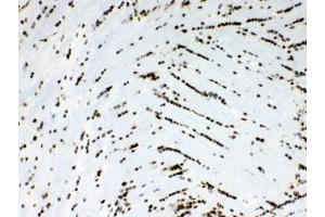 Immunohistochemistry (IHC) image for anti-Musashi Homolog 1 (Drosophila) (MSI1) (AA 21-54) antibody (ABIN5647867)