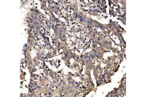 IHC analysis of PAR-3/PARD3 using anti-PAR-3/PARD3 antibody (ABIN7598983).