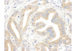 Immunohistochemistry (IHC) image for anti-Inositol 1,4,5-Trisphosphate Receptor, Type 3 (ITPR3) (AA 625-675) antibody (ABIN7448977)