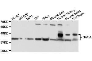 Western blot analysis of extracts of various cell lines, using NACA antibody. (NACA 抗体  (AA 1-215))