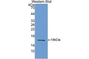 Western blot analysis of the recombinant protein. (Galectin 9 抗体  (AA 194-322))