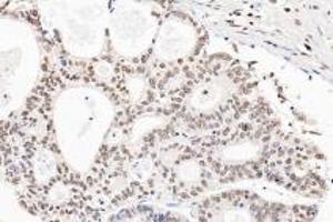 Immunohistochemistry (Paraffin-embedded Sections) (IHC (p)) image for anti-Ring Finger Protein 1 (RING1) antibody (ABIN7075467)